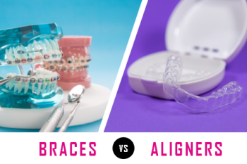 Odenton dentist, Dr. Zamora of Bayside Kids Dental talks about what factors need to be considered when deciding between getting braces or clear aligners for corrections.