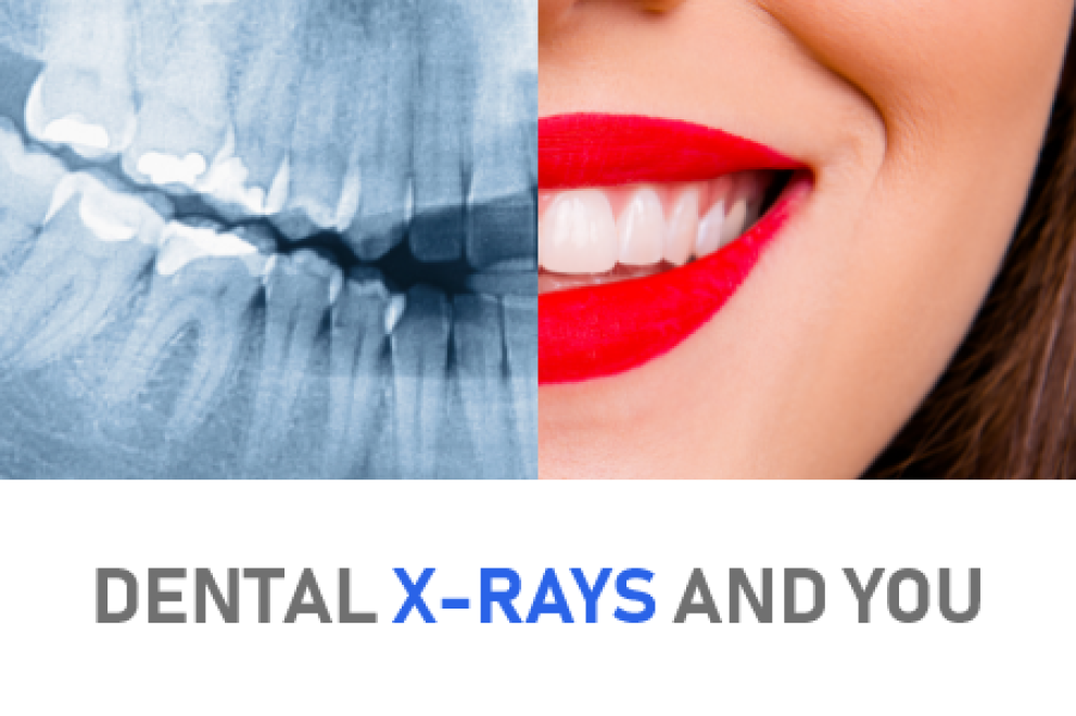 dental-x-rays-you-odenton-md-bayside-kids-dental