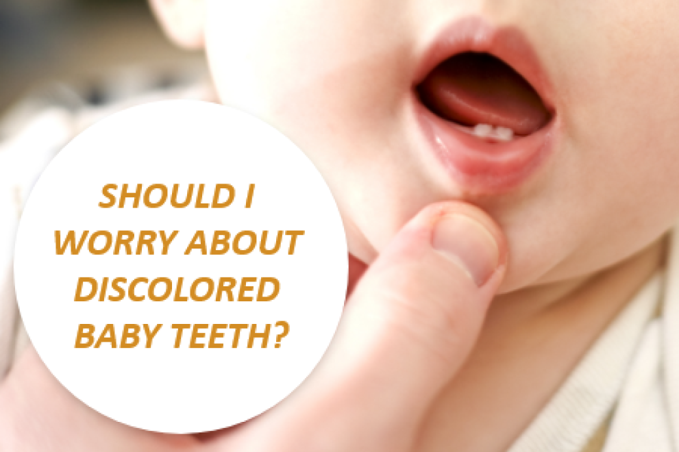 Why Kids Teeth Can Be Discolored Bayside Kids Dental Odenton, MD