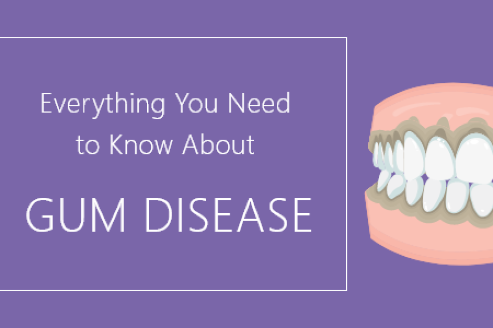 Everything You Need to Know About Gum Disease Bayside Kids Dental
