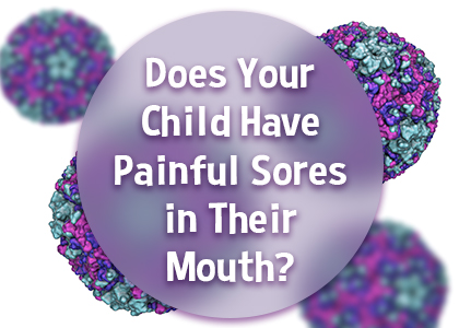 Odenton dentists, Drs. Sarrah & Kenny Zamora at Bayside Kids Dental tell parents about a common viral infection that may present with sores in your child’s mouth.