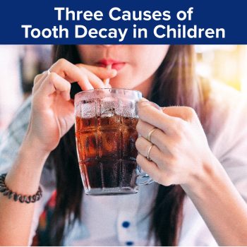 Odenton dentists, Drs. Kenny and Sarrah Zamora at Bayside Kids Dental, discuss the three causes of tooth decay in children. Read on to understand what you need to avoid to help your child maintain a healthy smile and optimal oral health.