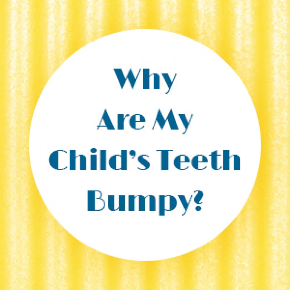 Mamelons Teeth in Odenton | Bayside Kids Dental