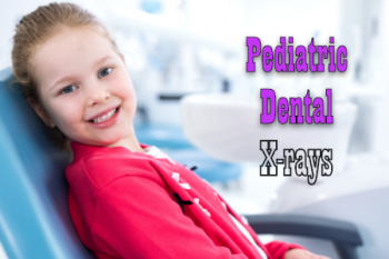 Looking for dental X-rays for kids? Visit Odenton dentists, Drs. Kenny and Sarrah Zamora at Bayside Kids Dental, and learn about dental X-rays for your children, their benefits, and precautions.