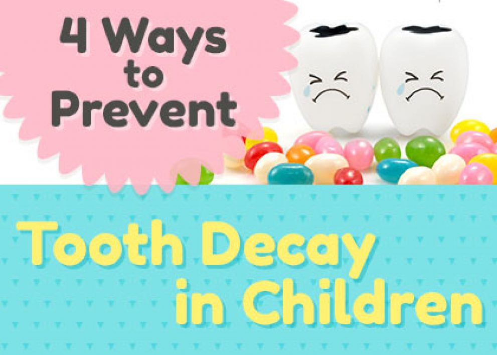 4 Ways to Prevent Tooth Decay in Odenton Children ǀ Bayside Kids Dental