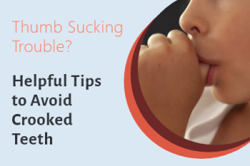 Odenton dentist, Drs. Kenny & Sarrah Zamora at Bayside Kids Dental explains the potential problems that can come from thumb sucking and what steps can be taking.
