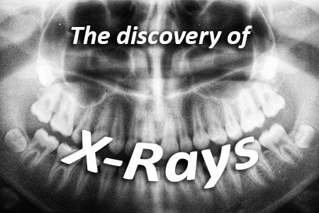 Odenton dentists, Drs. Sarrah & Kenny Zamora at Bayside Kids Dental discuss the discovery of x-rays and how they have advanced over the years.